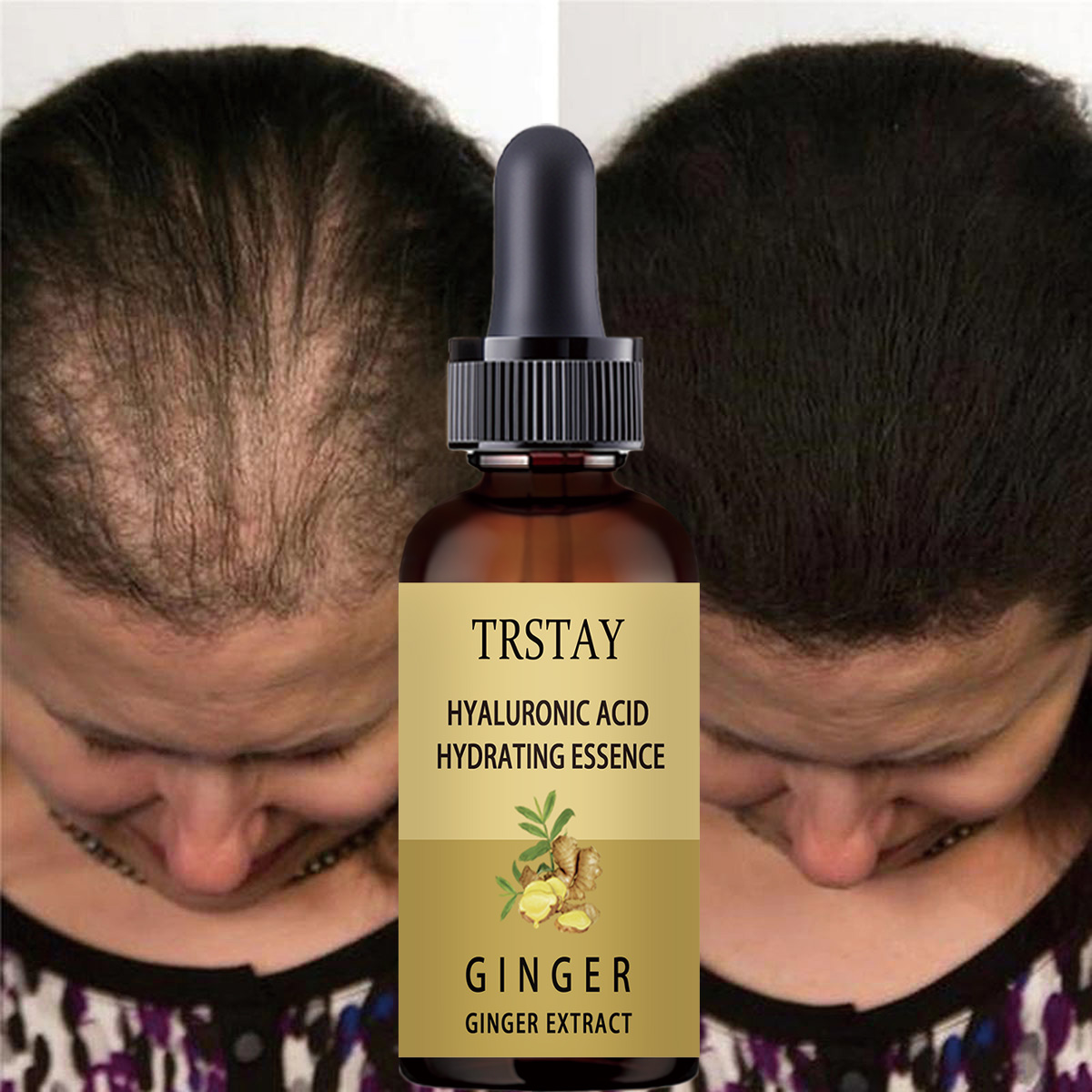 Caffeine Hair Serum - Suero para el crecimiento del cabello,