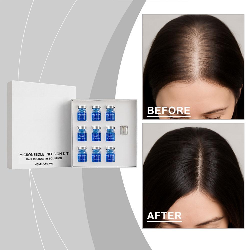 Hair Care Conditioner - Set de Rodillo de Microagujas con