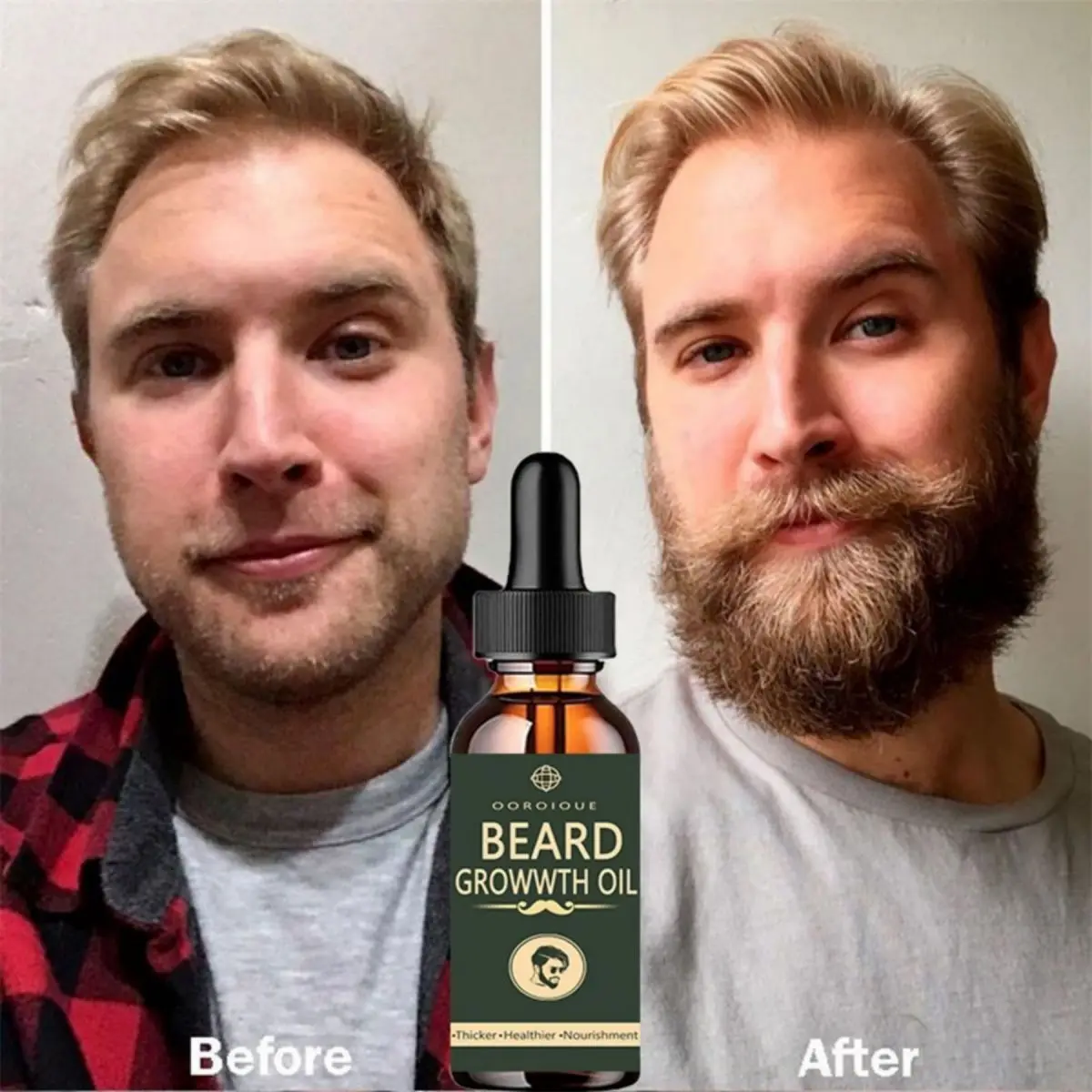 Caffeine Hair Serum - Aceite de crecimiento rápido de barba,