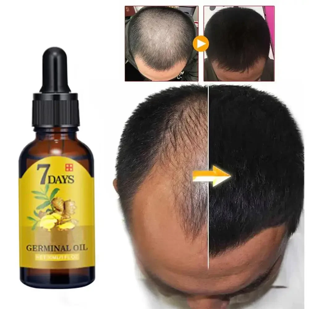 Hair Care Oil Serum - Aceite esencial de jengibre para el