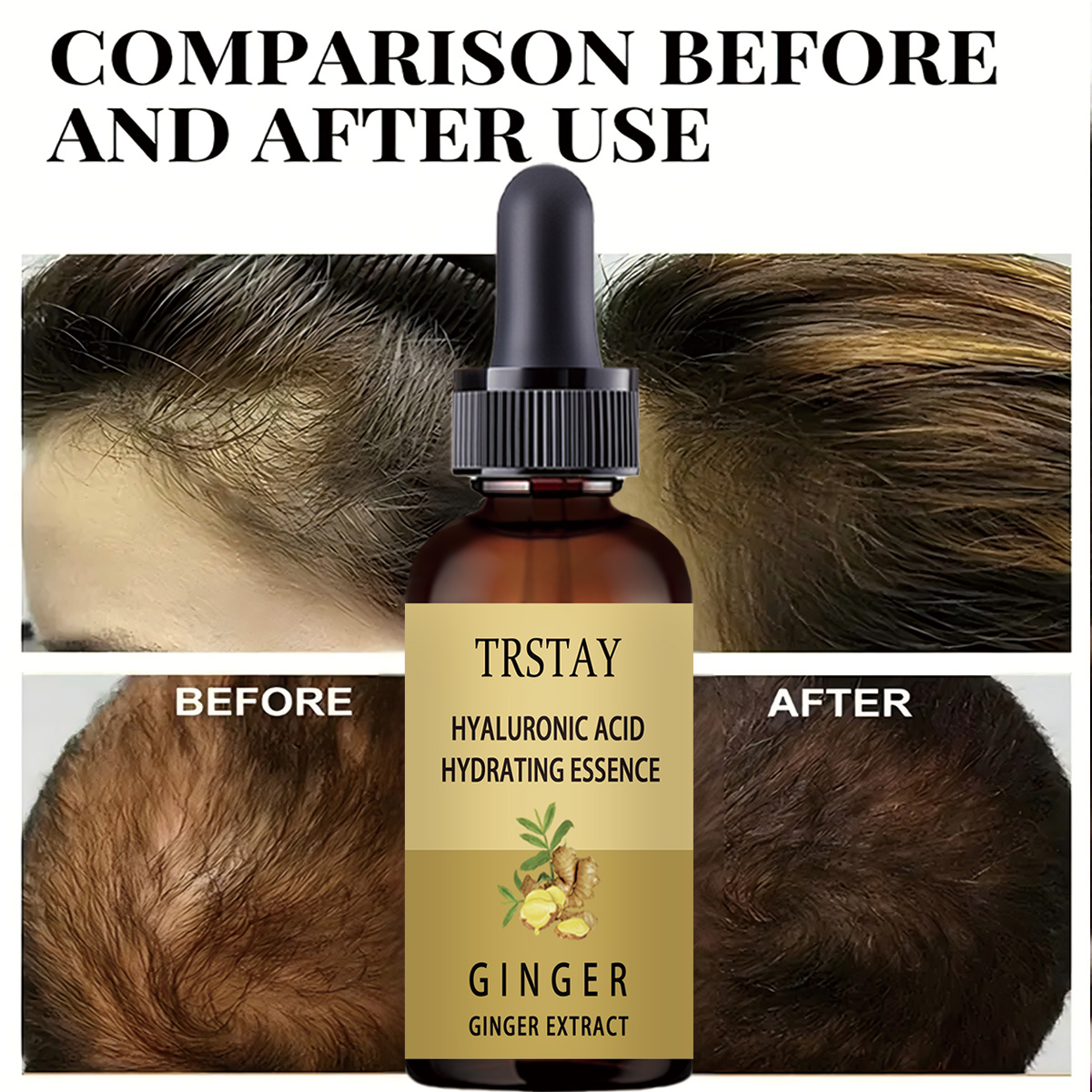 Suero para el crecimiento del  - Caffeine Hair Serum reseña y precio