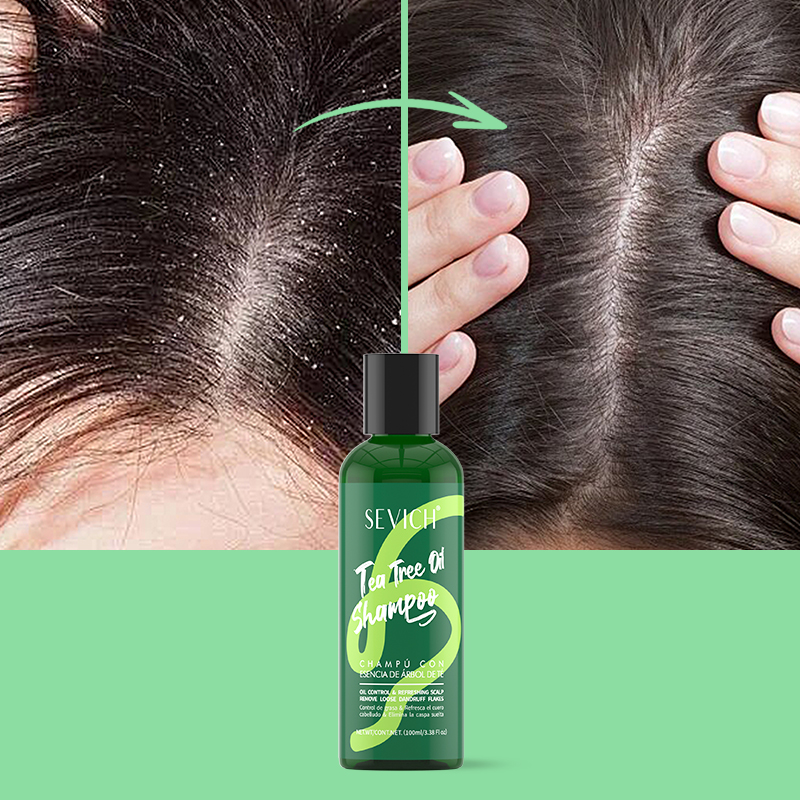 Champú con esencia de árbol de - Hair Care Conditioner reseña y precio