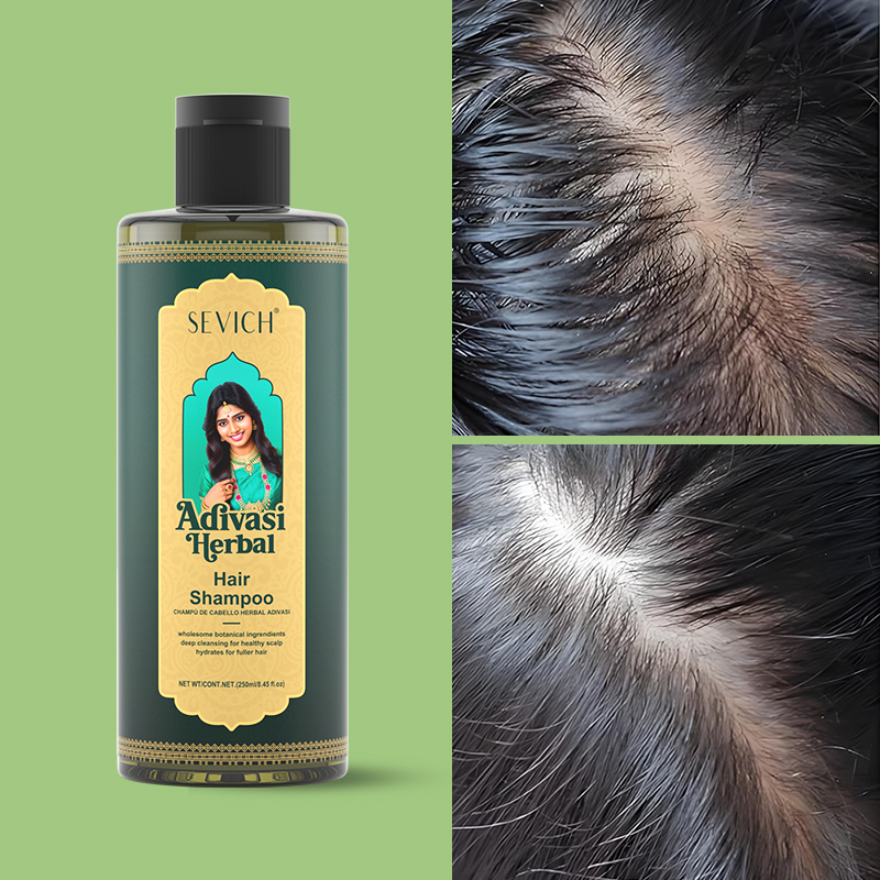 SEVICH-Juego de aceites para e - Hair Care India reseña y precio