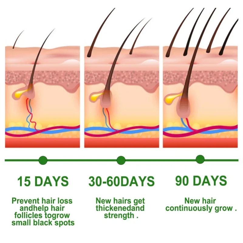 Suero para el crecimiento del  - Hair Care Gift Set reseña y precio