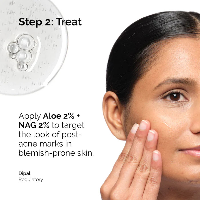 Aloe 2% + NAG 2% Solución Suer - Caffeine Hair Serum reseña y precio