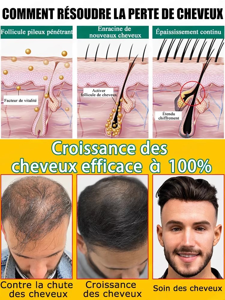 Suero anticaída y crecimiento  - Hair Care For Hair Fall reseña y precio