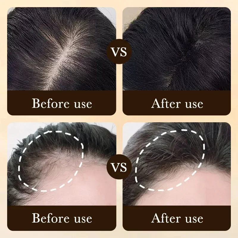 Aceite de Biotina para el Crec - Hair Care Oil Serum reseña y precio