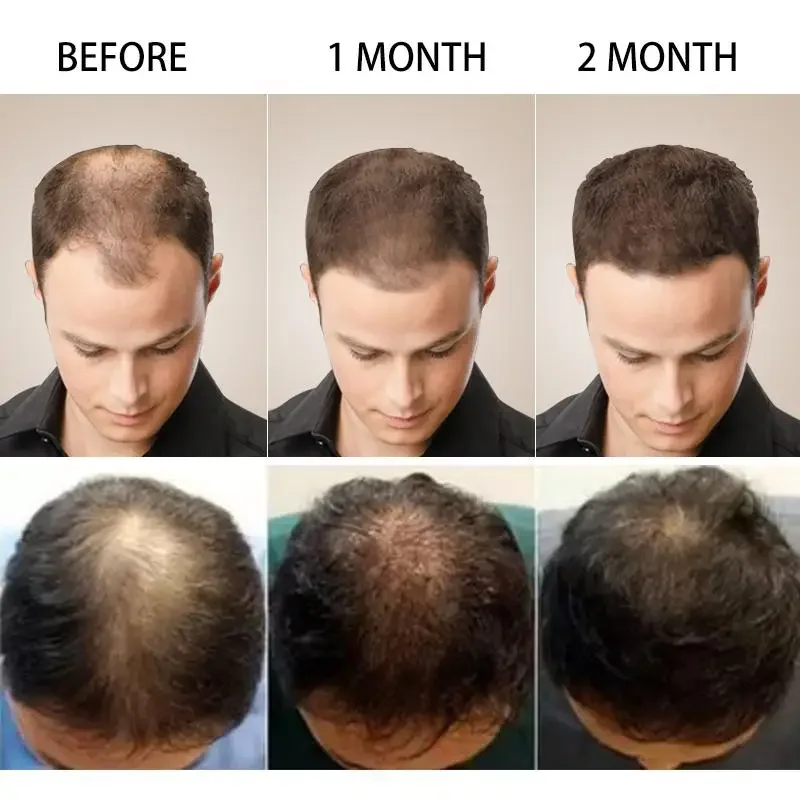 Aceite esencial de jengibre pa - Hair Care Oil Serum reseña y precio