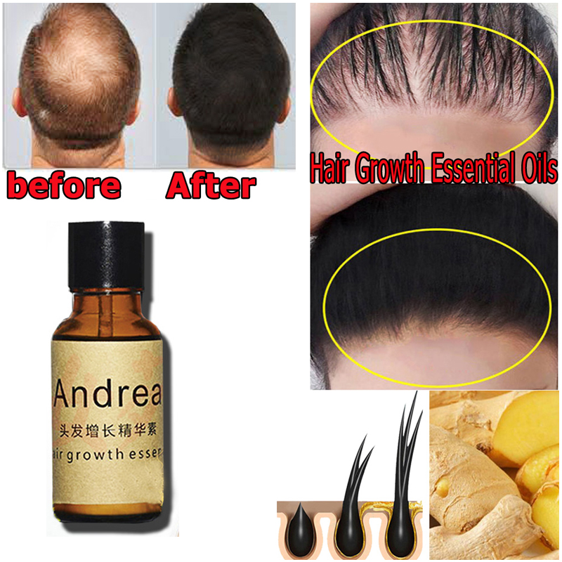 2/5/10 Uds. Aceite de suero pa - Hair Care Oil Serum reseña y precio